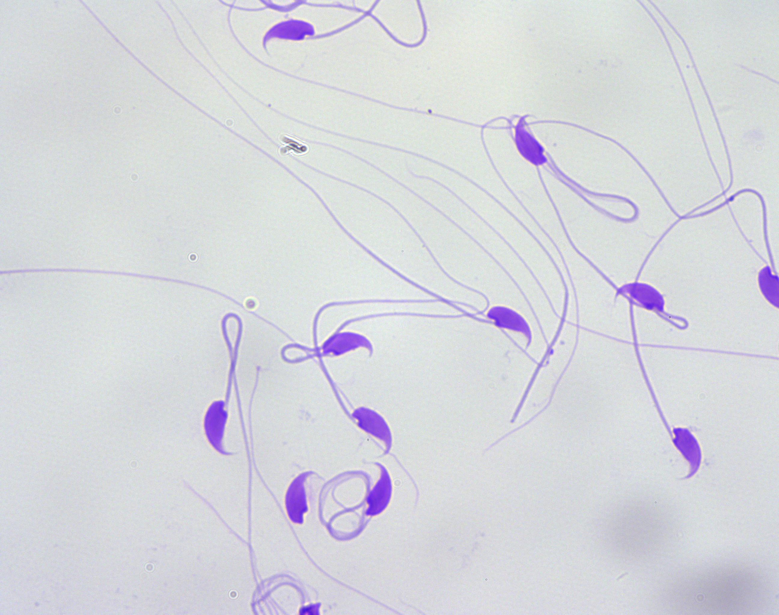 高精度识别正常异常形态精子